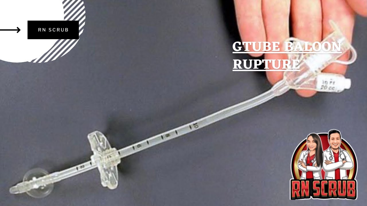 G- Tube Balloon Rupture