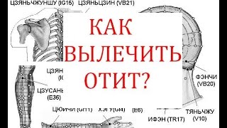 Как вылечить отит?(, 2016-01-28T17:36:24.000Z)