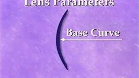 Design & Fitting of Soft Contact Lenses