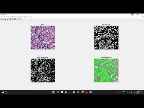 Histo Nuclei &