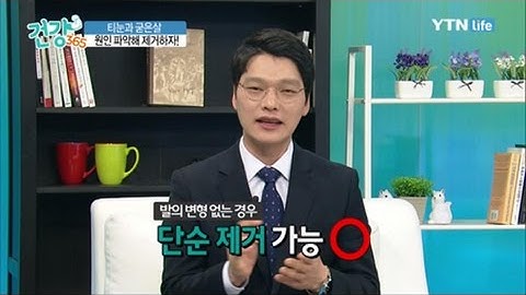 티눈과 굳은살, 한 번에 쉽게 제거할 수 있을까? / YTN 라이프