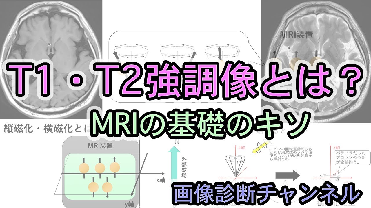 T1強調像 T2強調像とは Mriの基礎のキソ Youtube