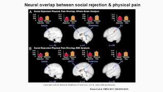 Lec 19 | MIT 9.00SC Introduction to Psychology, Spring 2011