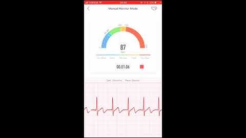 ECG Signal analysis and automated give a report on wearable device