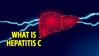 What is Hepatitis C