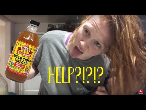 watch-me-pour-apple-cider-vinegar-all-over-my-head!!?!-|-eczema-&-psoriasis-help