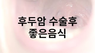 후두암 수술후 좋은음식 예후관리가 정말 중요합니다