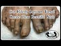 Pedicure Tutorial: Ingrown Toenail Treatment on Elderly and Create Clean Clear Nails