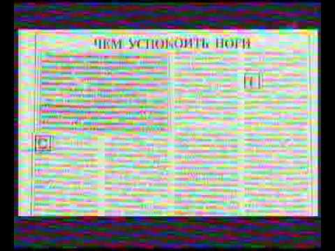 Управление сном 1 канал Синдром беспокойных ног Управление сном 1 канал Синдром беспокойных ног
