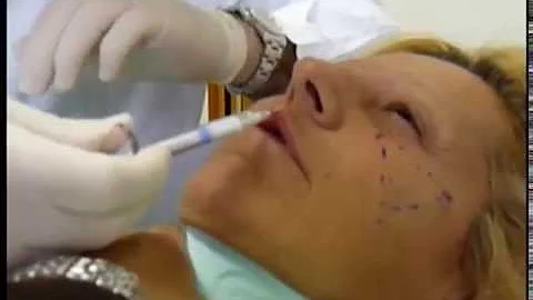 Come si chiama la zona tra naso e labbra?