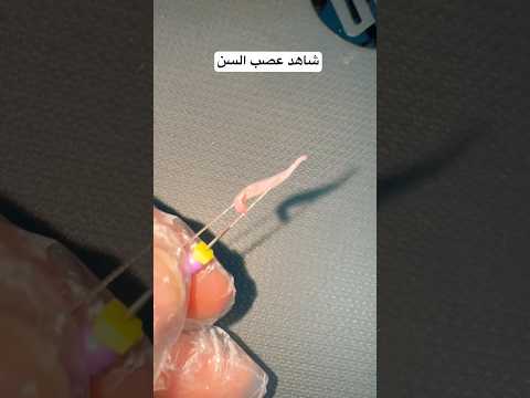 شاهد عصب الأسنان لأول مرة على اليوتيوب            