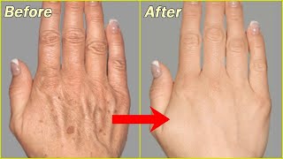 Fair + Soft + wrinkle free hands in just 1 night | Healthy Tips | Must Watch screenshot 1
