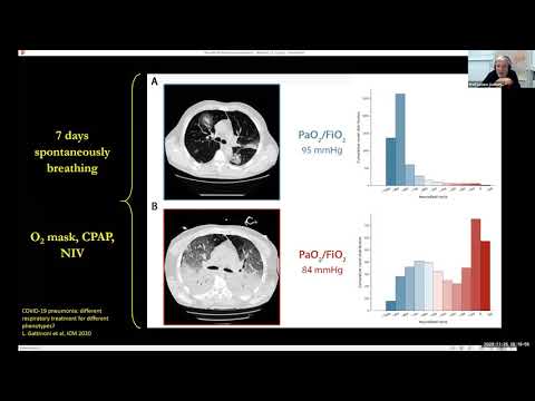 Mindray mysafety academy: ARDS Management Webinar