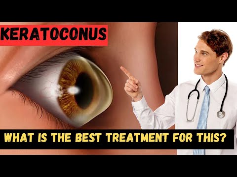 What Is Keratoconus?