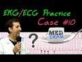 12 Lead ECG Practice Strip Interpretation - EKG Case 10