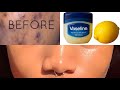 Lemon +vaseline magic to skin