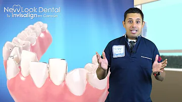 ¿Cuánto se mueven los dientes Invisalign a la semana?