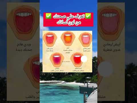 تعرف علي صحتك من لون لسانك اكسبلور Freefire Foryou Fyp لايك Music 