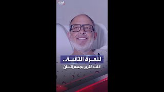 ثاني جراحة زرع قلب خنزير لرجل.. والفريق الطبي يؤكد نجاح العملية