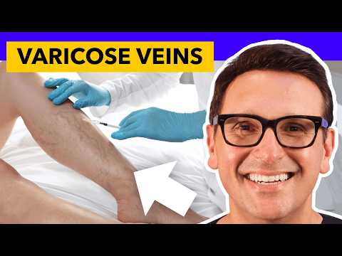 Video Can Varicose Veins cause Leg Swelling or Pain?