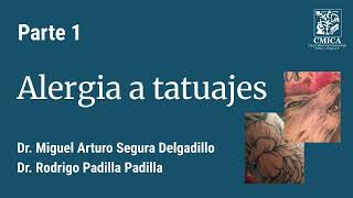 Tatuajes y Alergia