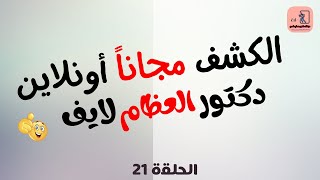 الكشف مجاناً أون لاين .. دكتور العظام لايف .. الحلقة 21