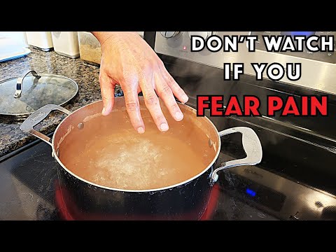 What if you dunked your entire hand in BOILING WATER?!