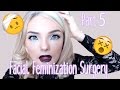 Facial Feminization Surgery - Week 2! |  | Stef Sanjati