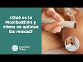 Moxibustión: Qué es y qué beneficios tiene