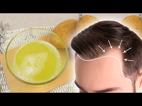 How to Stop Hair Loss Naturally