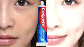 японский секрет как отбелить кожу лица за ночь! как выглядеть на 10 лет моложе