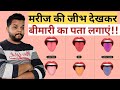       how to examine patients tounge in hindi  clinical tips
