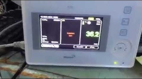 Vital Sign Patient Monitor with emdedded HL7 ve XML interface engine ...