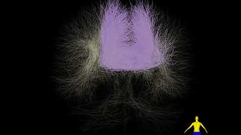 Tract-specific Study of the Corpus Callosum