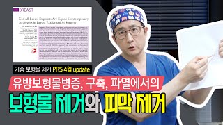 (Eng Sub) [피막 제거수술에 대한 최신 update①] 가슴보형물병증, 구축, 파열 보형물제거
