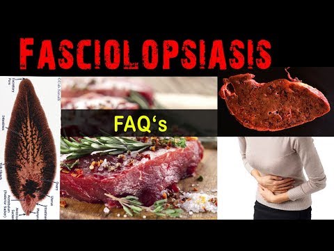 Video: Parasites In The Human Liver - Symptoms And Treatment