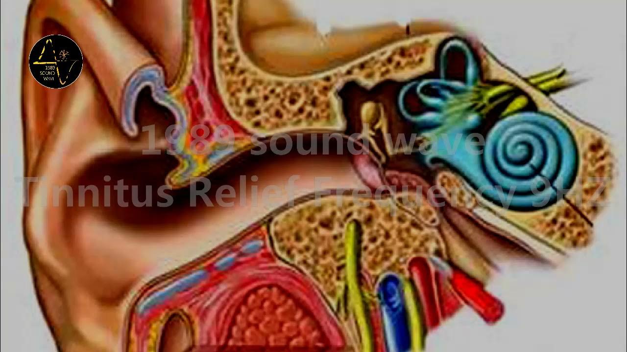 сенсоневральная тугоухость слуховой аппарат. барабанная перепонка при тугоухости. иглоукалывание при неврите. кохлеарный неврит слухового нерва. нервное ухо.