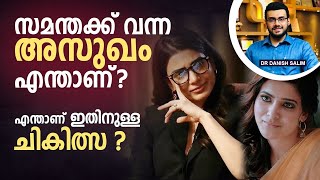 1626: തെന്നിന്ത്യൻ സിനിമാതാരം സാമന്ത ബാധിച്ച രോഗമെന്താണ്?   What is Samantha’s disease?