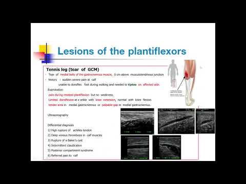 contractile structure , ankle