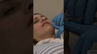 Que nervios!!! procedimiento estetico #parati ##foryou #fyp #lipfiller