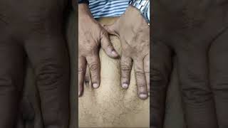 Expansile Abdominal Pulsation In A Case Of Aortic Aneurysm