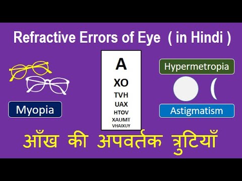 Refractive Errors of Eye: causes, types, and treatment in Hindi. #