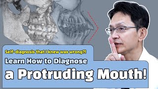 Banobagi Plastic Surgery With Dr. Oh Learn How To Diagnose A Protruding Mouth