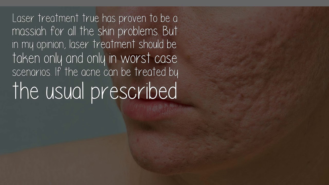 Is Laser Treatment A Permanent Solution For Oily Skin And Acne? YouTube