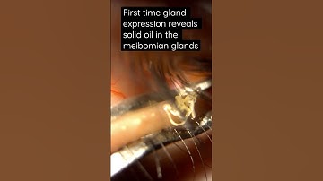 Another shocking first time gland expression