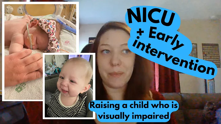 Quinn's journey: NICU, Cortical Visual Impairment (CVI), and early intervention