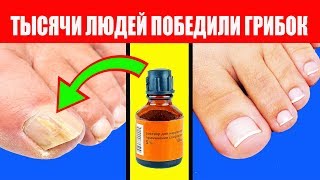 Here is a Good Remedy to Get Rid of Nail Fungus