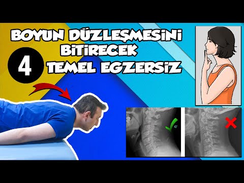 Boyun Düzleşmesini 4 Basit Egzersiz İle Düzelt !