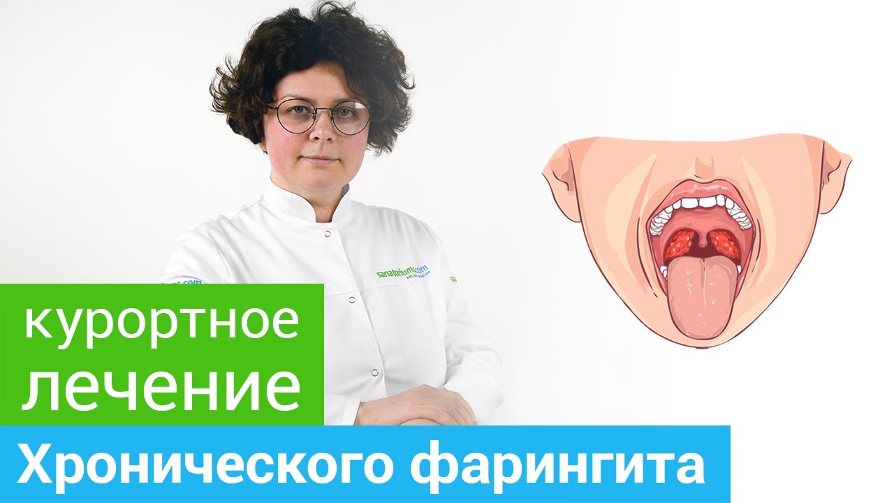 Где и как лечить ХРОНИЧЕСКИЙ ФАРИНГИТ. Профильные курорты и методы ...