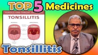 Top 5 - Homeopathy Medicines for Tonsillitis - Dr P. S. Tiwari